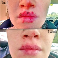 Charcoal Face Mask - Thumbnail 3