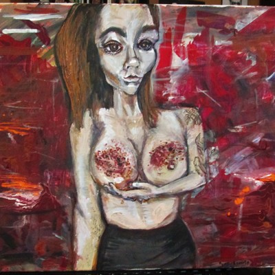 Bruise odyssey delrose