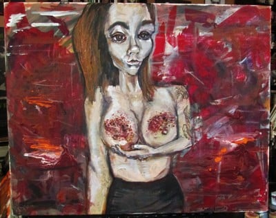 bruise odyssey Delrose