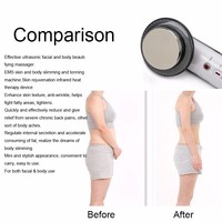 Personal Health Anti Cellulite Massager 3in1 Ultrasonic+Infrared+EMS for Home Use - Thumbnail 1