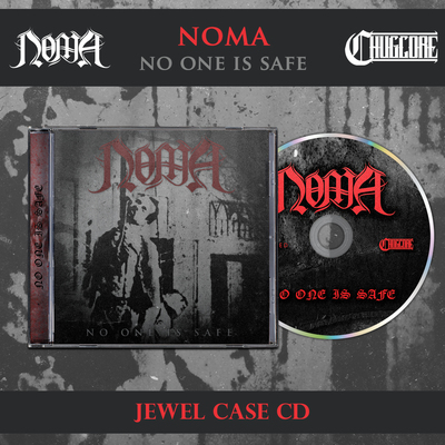 Noma - no one is safe