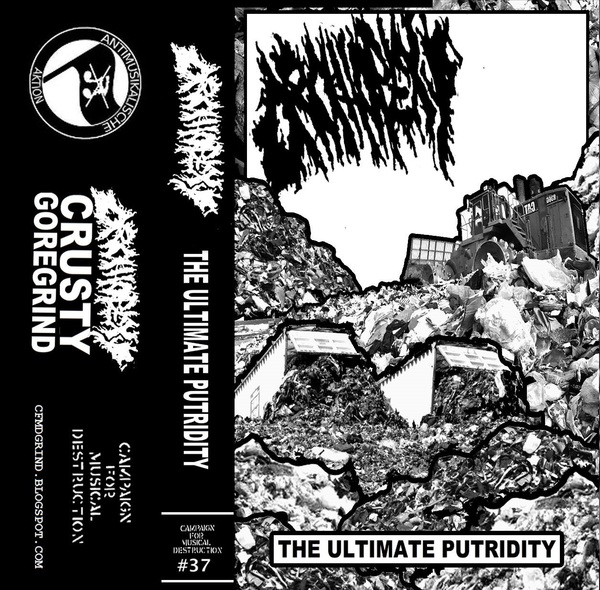 Orchiopexy "The Ultimate Putridity" Tape