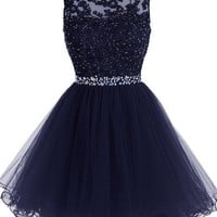  Charming dark blue lace short prom dress,homecoming dresses,graduation dress - Thumbnail 1
