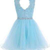 Tulle Homecoming Dress,Lace Homecoming Dress,Blue Homecoming Dress,Fitted Homecoming Dress,Short Prom Dress - Thumbnail 1