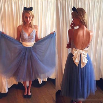 Backless tea-length prom dress,homecoming dress,graduation dress,party dress f41