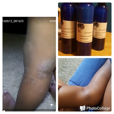 Eczema-llent Aloe Vera Skin Cream