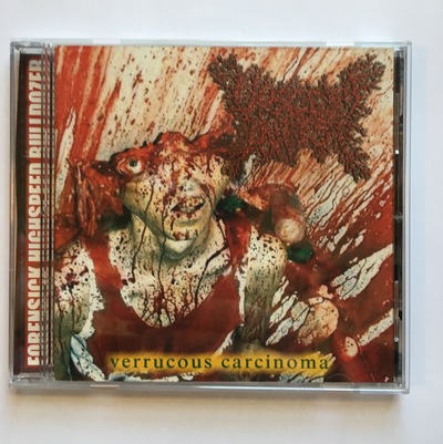 Viscera Infest - "Verrucous Carcinoma" CD