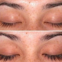 Grow Longer Lashes (1 bottle and 1 brush)  - Thumbnail 3