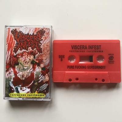 Viscera infest - "verrucous carcinoma"