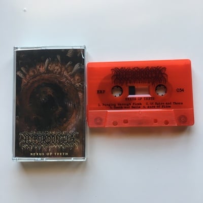 Hyperdontia - "nexus of teeth"