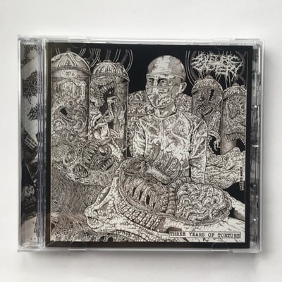 Sulphuirc cautery - "three years of torture"