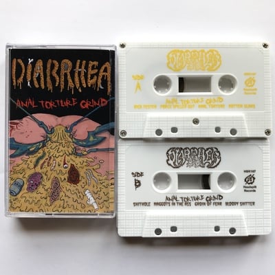 Diarrhea - "anal torture grind"