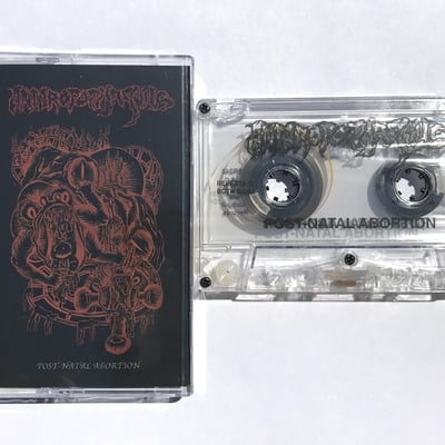 Anthropophagous - "post-natal abortion"