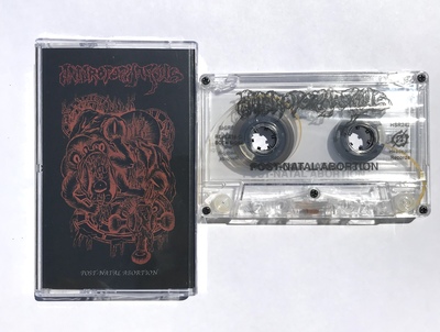 Anthropophagous - "Post-Natal Abortion"