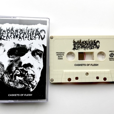Leprophiliac - “caskets of flesh”
