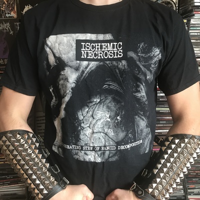 Ischemic Necrosis T-shirt 