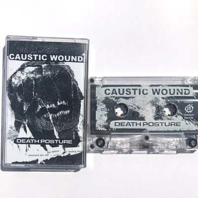 Caustic wound - "death posture"