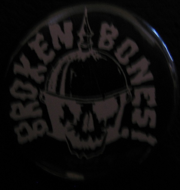 BROKEN BONES 1 1/4"
