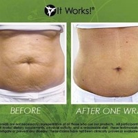 Botanical body wrap - Thumbnail 2